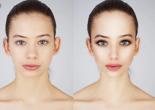 lifting du visage