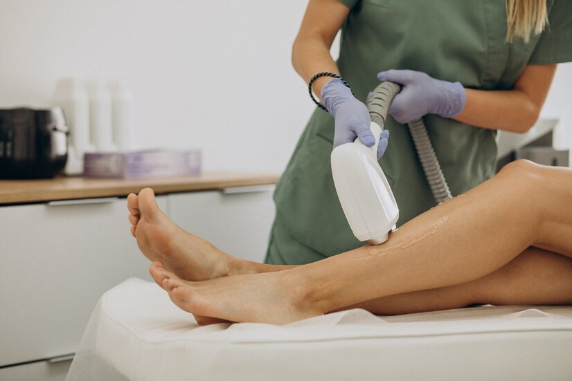 Comment se passe une épilation au laser pour le visage ?