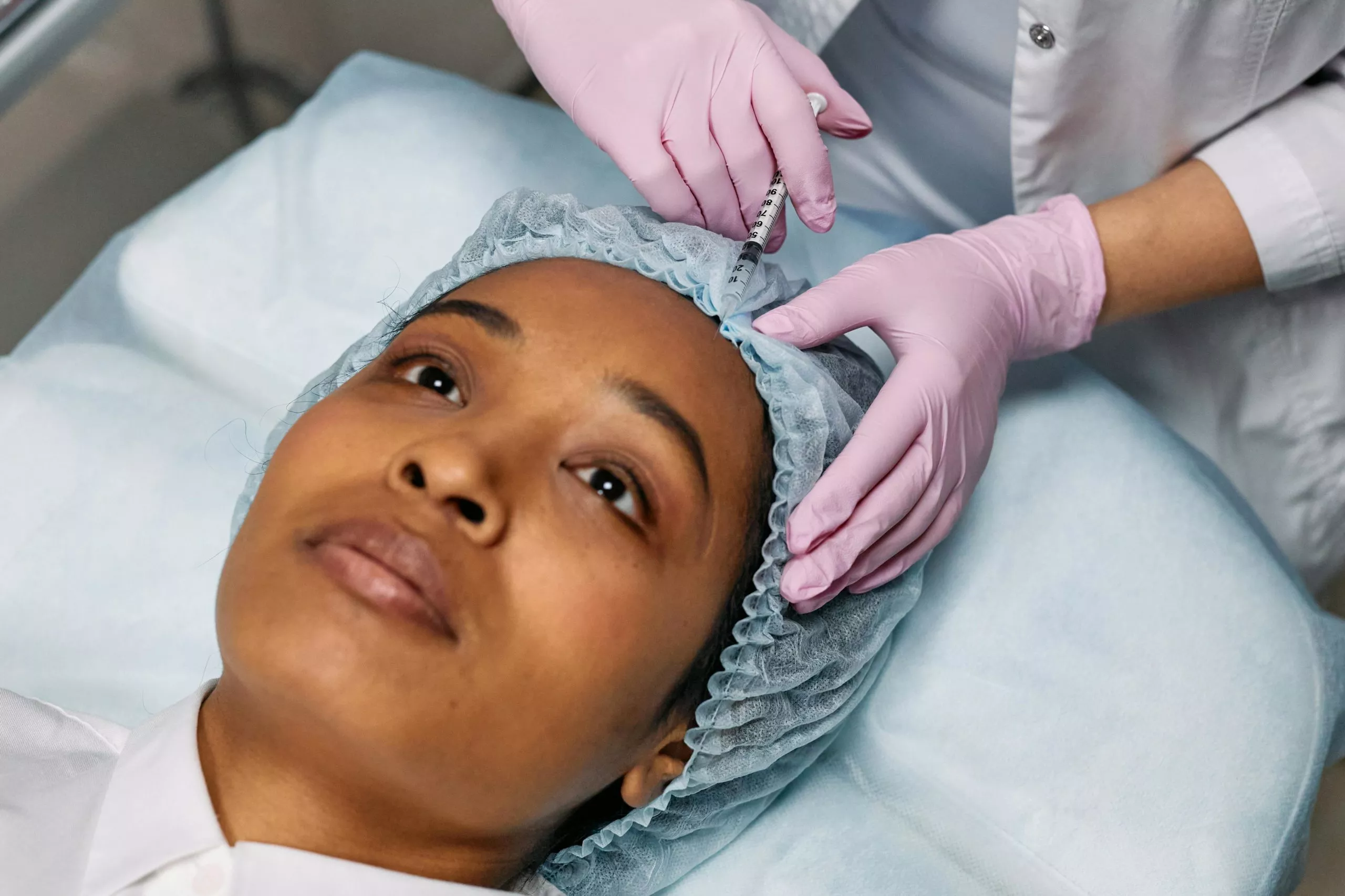 Les résultats de l’acide hyaluronique en Médecine esthétique