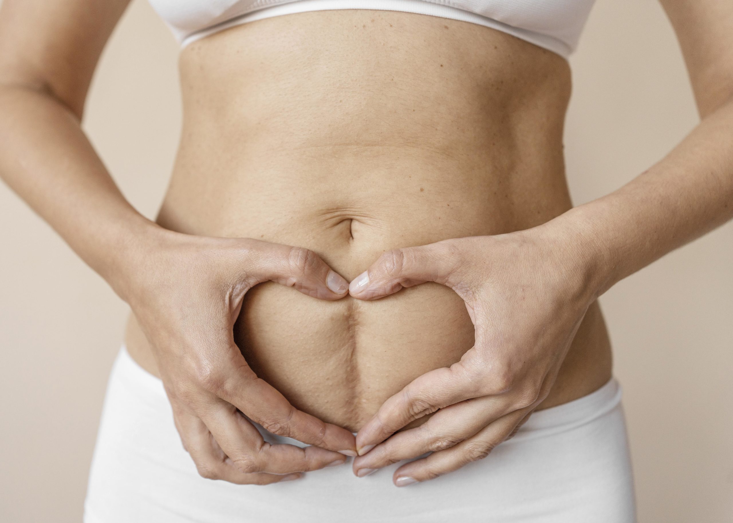 Pourquoi l’abdominoplastie en chirurgie esthétique ?
