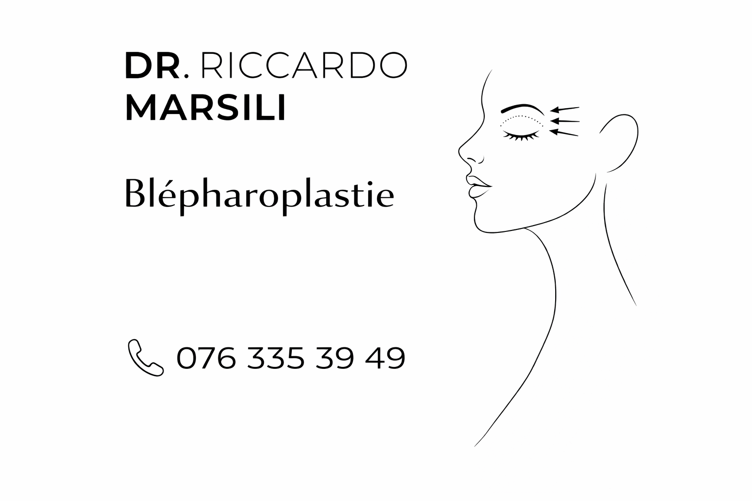 Blépharoplastie Lausanne : Tout savoir